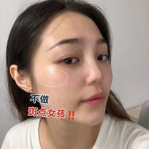 外国妞为什么雀斑多呢